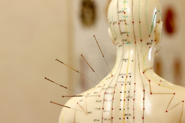 Mitos e Verdades sobre a Acupuntura: o que você precisa saber antes de começar