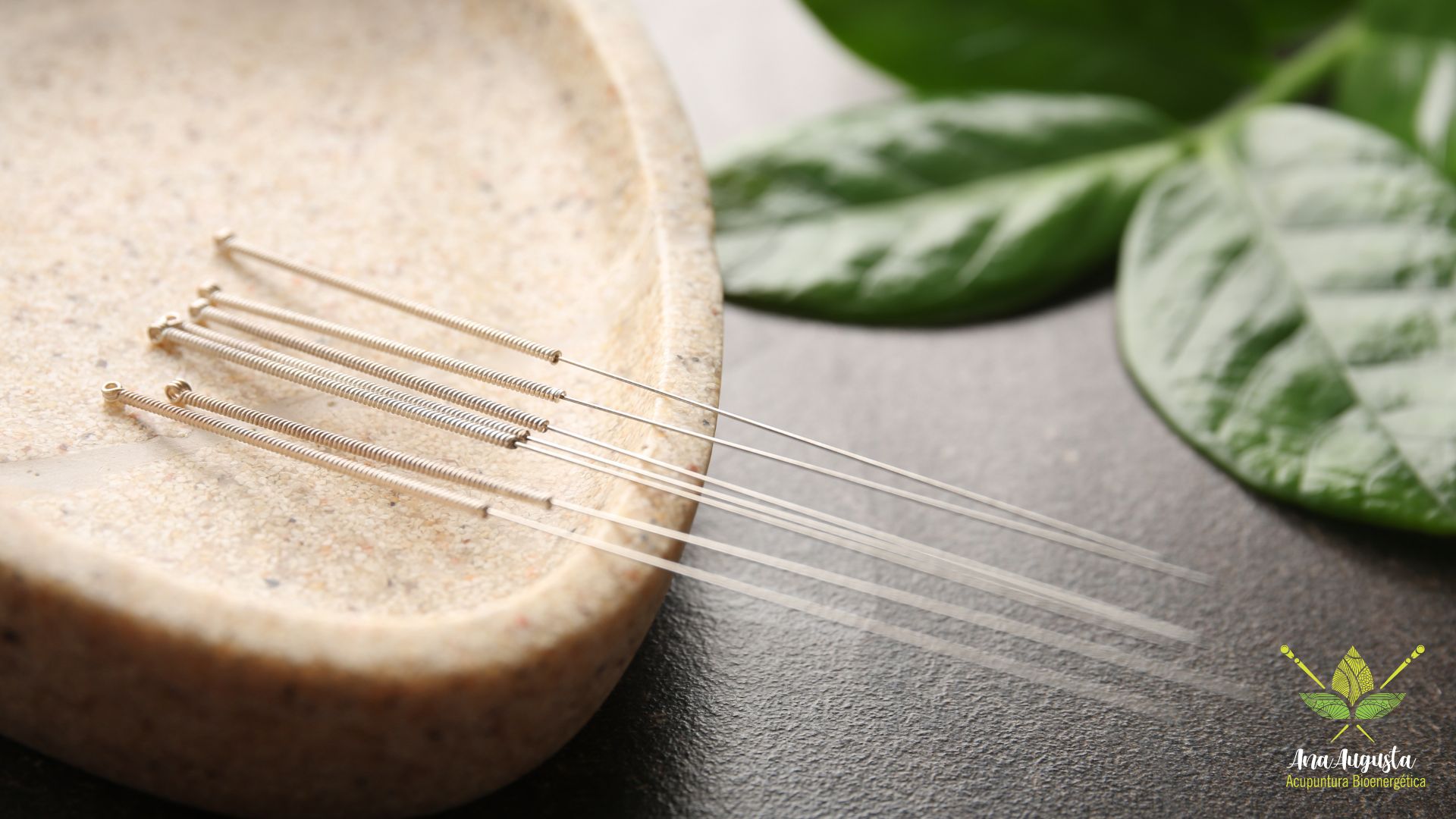 Acupuntura: o que você precisa saber